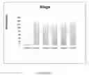 Fig. 07 - Materials and methods for detecting cancer based on urinary levels of RHAMM