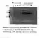 Fig. 01 - Use of a Fibrinogen Capture Agent to Detect a Ciz1 B-Variant