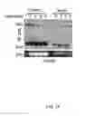 Fig. 06 - Methods and compositions relating to proteasome inhibitor resistance