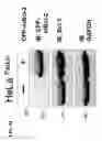 Fig. 35 - METHODS FOR PREDICTING CANCER PATIENT'S CLINICAL RESPONSE TO ANTI-CANCER COMPOUNDS