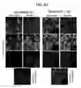 Fig. 40 - METHODS FOR PREDICTING CANCER PATIENT'S CLINICAL RESPONSE TO ANTI-CANCER COMPOUNDS