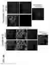 Fig. 41 - METHODS FOR PREDICTING CANCER PATIENT'S CLINICAL RESPONSE TO ANTI-CANCER COMPOUNDS