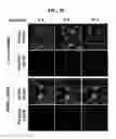 Fig. 45 - METHODS FOR PREDICTING CANCER PATIENT'S CLINICAL RESPONSE TO ANTI-CANCER COMPOUNDS