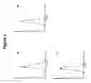 Fig. 02 - Blood preparation and profiling