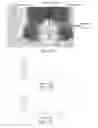 Fig. 29 - Systems, devices, and methods for ultra-sensitive detection of molecules or particles