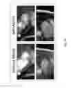 Fig. 40 - Low-rank tensor imaging for multidimensional cardiovascular MRI
