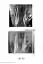 Fig. 43 - Low-rank tensor imaging for multidimensional cardiovascular MRI