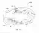 Fig. 09 - Configurable ambidextrous input device