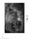 Fig. 04 - Dynamic thumbnails