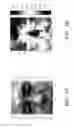 Fig. 02 - Driver state determination device and driver state determination method