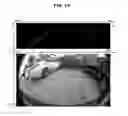 Fig. 16 - Method of detecting obstacle around vehicle