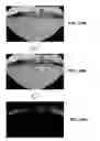 Fig. 20 - Method of detecting obstacle around vehicle