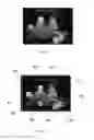 Fig. 03 - Method and a device for image matching