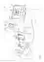 Fig. 02 - Registration of an anatomical image with a position-tracking coordinate system based on proximity to bone tissue