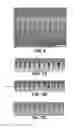 Fig. 08 - DENSIFYING FILMS IN SEMICONDUCTOR DEVICE