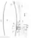 Fig. 56 - CONFIGURABLE HIGH TEMPERATURE CHUCK FOR USE IN A SEMICONDUCTOR WAFER PROCESSING SYSTEM