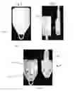 Fig. 06 - Cable management systems and methods