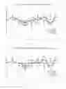 Fig. 15 - Overlapped multiplexing modulation method, apparatus and system