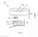 Fig. 09 - Bone conduction hearing aid system