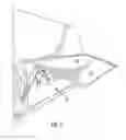 Fig. 05 - Rear mount bale spreader