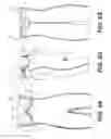 Fig. 03 - Shaping garment with fit-adjustable brassiere portion