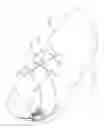 Fig. 32 - Closure system and/or shoe configurations for enhancing the performance of running shoes