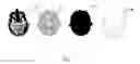 Fig. 04 - Medical Imaging Stabilization and Coregistration