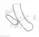 Fig. 02 - Endoscopic transluminal stent access and delivery system