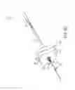 Fig. 09 - Endoscopic transluminal stent access and delivery system