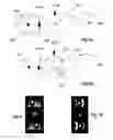 Fig. 08 - Systems and methods for creating hair transplantation procedure sites