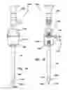 Fig. 02 - First-entry trocar system