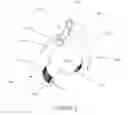 Fig. 07 - Percutaneous pedicle screw revision system