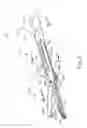 Fig. 03 - Articulation drive feature in surgical instrument
