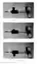 Fig. 04 - Rotatable endoscopic instrument
