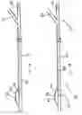 Fig. 03 - ESOPHAGEAL RETRACTOR WITH SENSOR