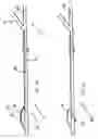 Fig. 04 - ESOPHAGEAL RETRACTOR WITH SENSOR