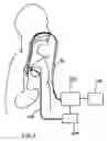 Fig. 07 - ESOPHAGEAL RETRACTOR WITH SENSOR