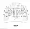 Fig. 02 - Dual expanding palatal distractor