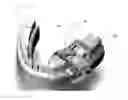 Fig. 01 - Disposable surgical intervention guides, methods, and kits
