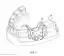 Fig. 06 - Disposable surgical intervention guides, methods, and kits
