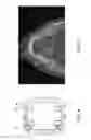 Fig. 07 - Disposable surgical intervention guides, methods, and kits
