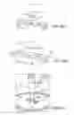 Fig. 17 - Disposable surgical intervention guides, methods, and kits