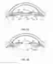 Fig. 02 - Intraocular devices and methods for correction of aphakia, restoration of accommodation, and treatment of glaucoma