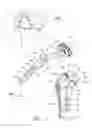 Fig. 02 - Implant