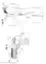 Fig. 09 - Medical device with induction triggered anchors and system for deployment of the same