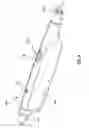 Fig. 04 - Motorized delivery systems for an enovascular device
