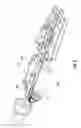 Fig. 07 - Motorized delivery systems for an enovascular device