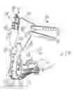 Fig. 01 - Method and apparatus for correcting foot and ankle problems and problems with gait