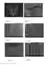 Fig. 08 - AMPHIPHILIC POLYMERS ENCAPSULATING THERAPEUTICALLY ACTIVE AGENTS
