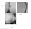 Fig. 09 - AMPHIPHILIC POLYMERS ENCAPSULATING THERAPEUTICALLY ACTIVE AGENTS